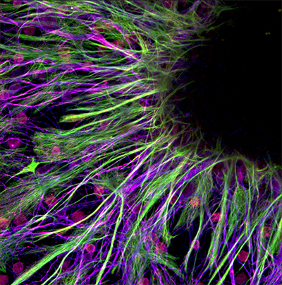 Neuronal outgrowths radiate from a 7 DIV rat spinal cord. Choline Acetyltransferase (motor neurons, red) and Tuj1 (neuron cytoskeleton, blue) immunohistochemistry colocalize indicating that these processes are nearly entirely cholinergic. Astrocytes (GFAP, green) are also present in great number demonstrating the multicellular complexity of the spinal cord. Collin Kaufman, Trainee